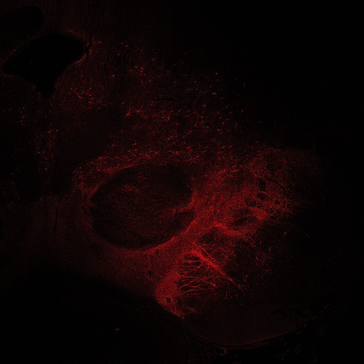 Human foetal midbrain